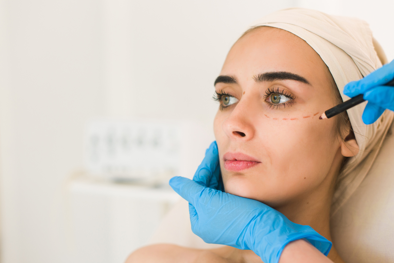 Woman having undereye area marked for cosmetic procedure